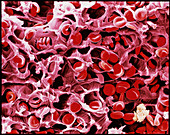 Coloured SEM of a blood clot due to an injury