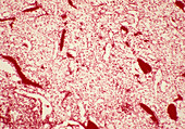Spleen pulp,light micrograph