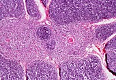 Light micrograph of a normal thymus
