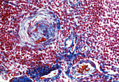 Medulla of thymus