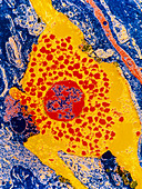 False-colour TEM of a human mast cell