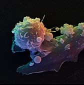 Colour SEM of immune cells: dendritic and T-cells