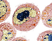 Dendritic cell,TEM