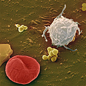 Blood cells and bacteria,SEM