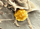 Phagocytosis of a fungus spore,SEM
