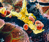 False-colour SEM of Kupffer cell in liver