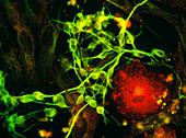 Immunofluorescent LM of macrophage in brain tissue