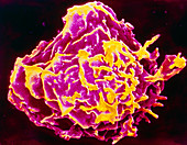 Coloured SEM of a macrophage
