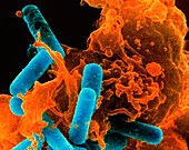 Colour SEM of phagocyte ingesting bacteria