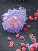 SEM of leucocyte with Staphylococcus bacteria