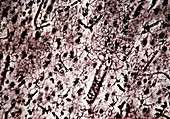 Microglia cells