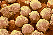 Neutrophil white blood cells,SEM