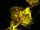 Neutrophil cell trapping bacteria,SEM