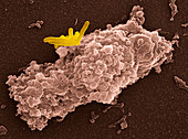 Macrophage engulfing bacteria,SEM