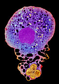 Neutrophil and trapped bacteria,TEM