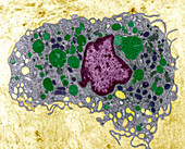 Macrophage cell,TEM