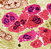 Neutrophil white blood cells,TEM