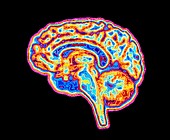 Image of sagittal section through human brain