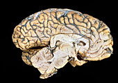 Side view of the anatomy of the human brain