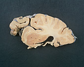 View of a slice through a healthy human brain