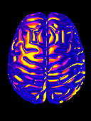 Computer artwork of human brain seen from above