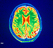 False-colour NMR scan of the head,axial section