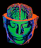 3-D CT brain scan