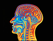 Coloured MRI scan of the human head (side view)
