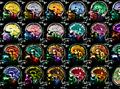 Coloured sagittal MRI scans of the human brain