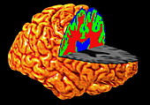 Human brain,3-D MRI scan