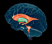 Ventricles of brain,MRI