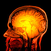 Brain anatomy,MRI scan