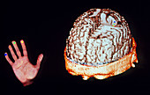 Computer image of brain-hand control from MEG scan