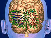 Functional map of the brain's visual cortex areas