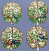 Functional map of the brain's visual cortex areas