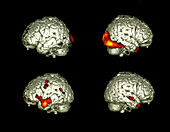 Brain activity viewing faces