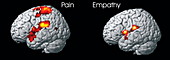Brain response to pain,MRI scans