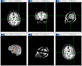 Brain mapping scans
