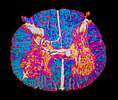 False-col LM of TS through human spinal cord