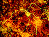 Immunofluorescent LM of neuron fibres & astrocytes