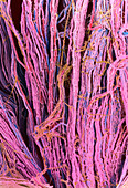 Coloured SEM of nerve fibres