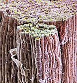 Nerve fibre,SEM