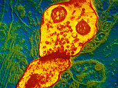 TEM of synapse between neurones in cerebral cortex