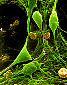 SEM of nerve cells from cerebral cortex