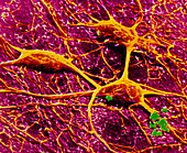 False-col SEM of 3 neurones of cerebral cortex