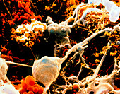 SEM of neurones and glial cells