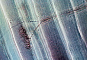 LM of a motor end plate in skeletal muscle