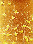 Nerve cells,SEM