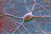Purkinje nerve cell,SEM