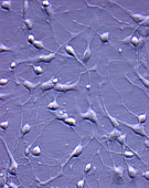 Foetal neurons